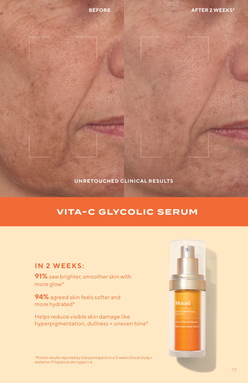 Before and after clinical trial results for Rapid Dark Spot Correcting Serum — 91% saw visibly brighter skin in 2 weeks