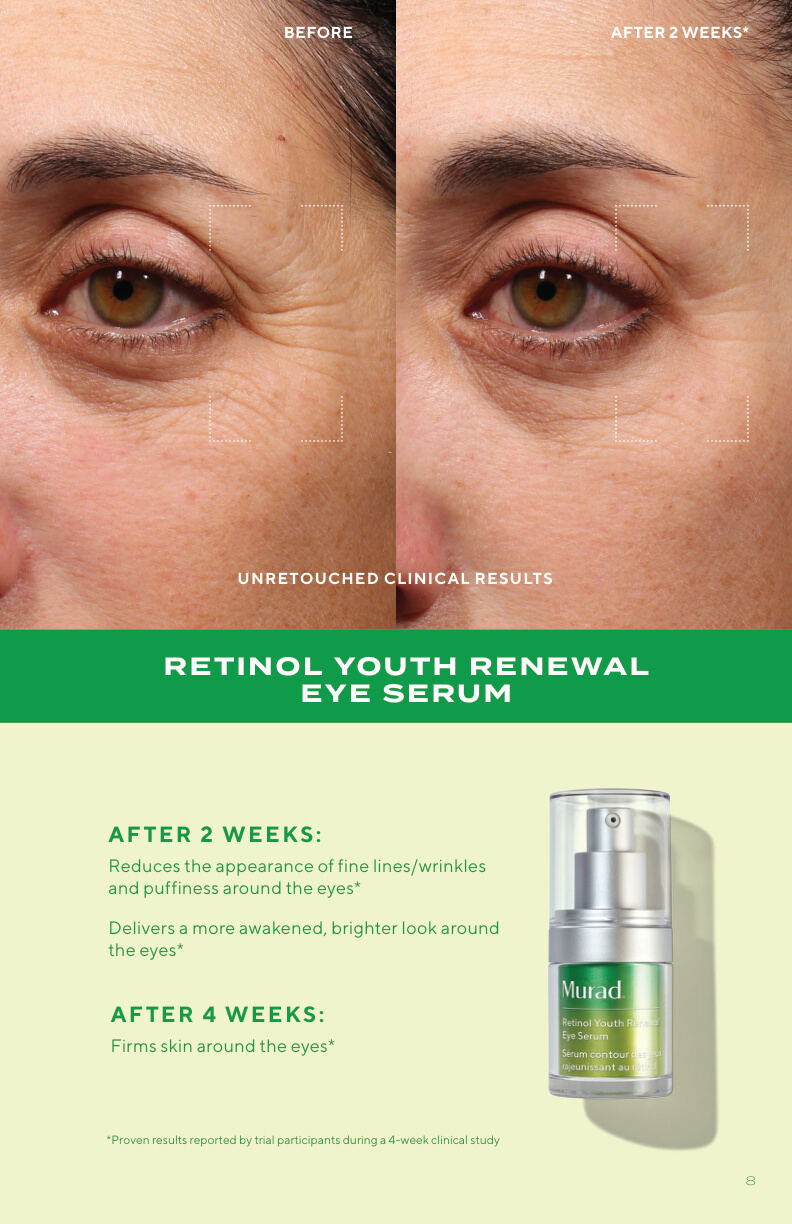 Retinol Youth Renewal Serum before and after After 2 weeks