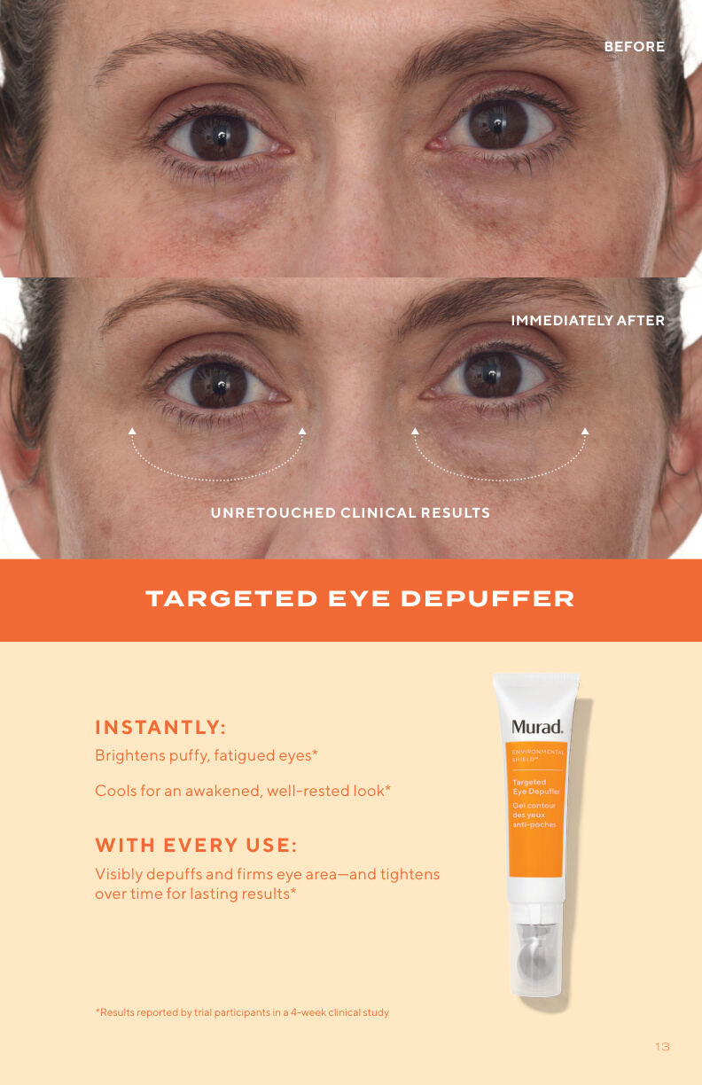 Before and after clinical trial results for Vita-C Glycolic Brightening Serum — 94% agreed skin feels softer & more hydrated